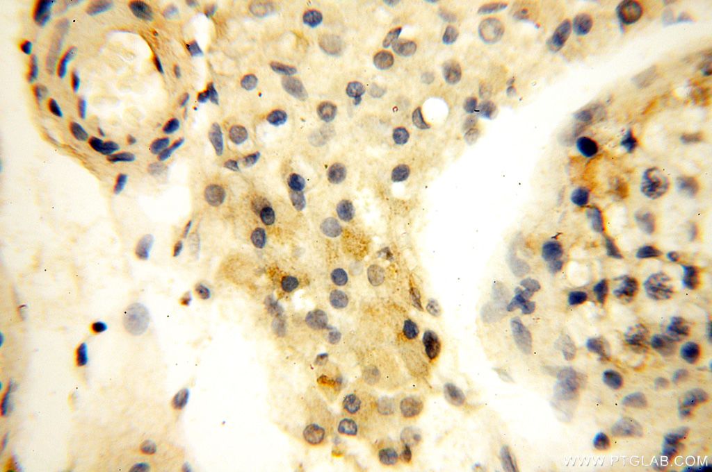 Immunohistochemistry (IHC) staining of human testis tissue using MRPL52 Polyclonal antibody (16800-1-AP)