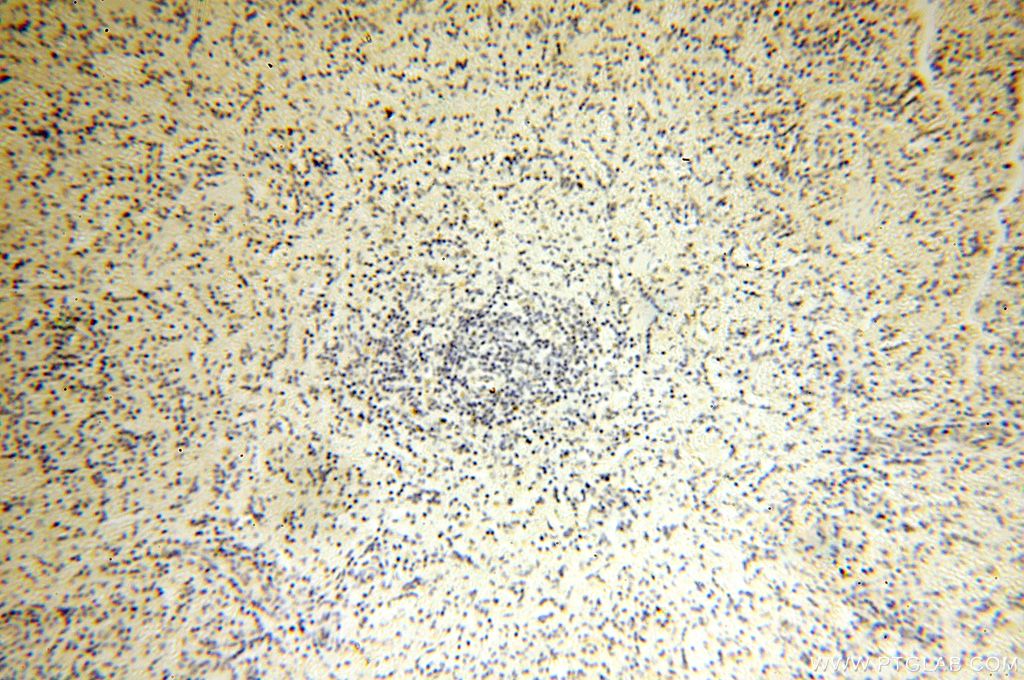 Immunohistochemistry (IHC) staining of human spleen tissue using MRPL52 Polyclonal antibody (16800-1-AP)