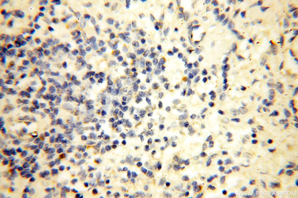 Immunohistochemistry (IHC) staining of human spleen tissue using MRPL52 Polyclonal antibody (16800-1-AP)