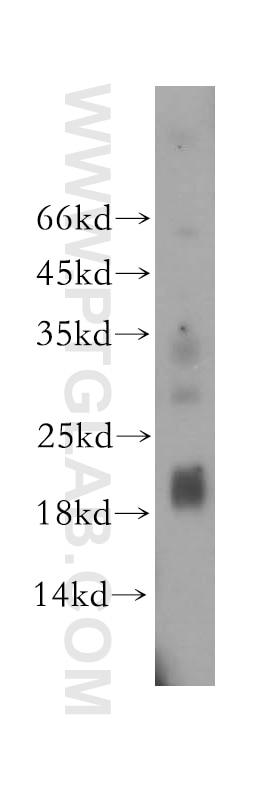 Western Blot (WB) analysis of HeLa cells using MRPL52 Polyclonal antibody (16800-1-AP)