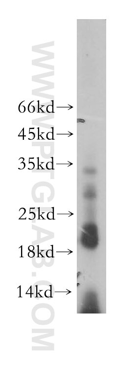 Western Blot (WB) analysis of human heart tissue using MRPL52 Polyclonal antibody (16800-1-AP)