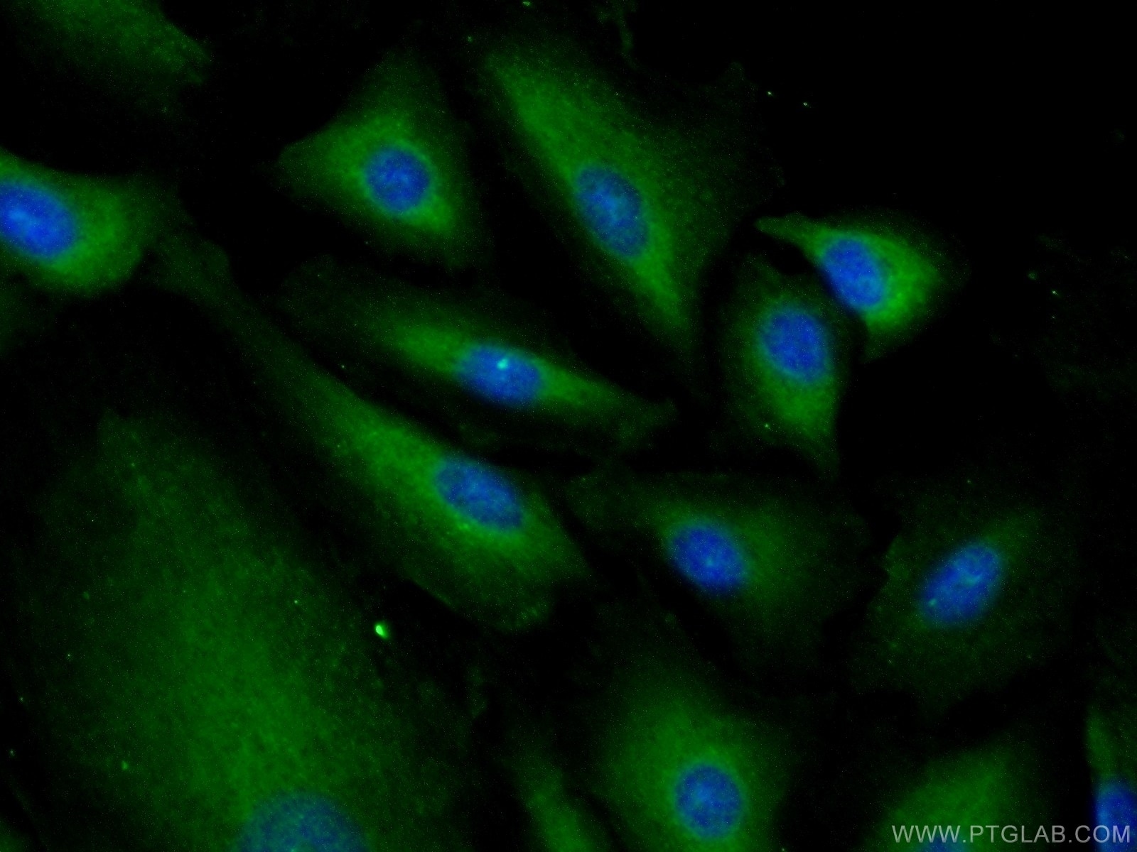 Immunofluorescence (IF) / fluorescent staining of A549 cells using MRPL53 Polyclonal antibody (16142-1-AP)