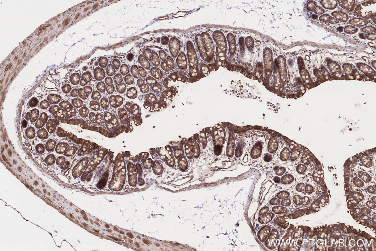 Immunohistochemistry (IHC) staining of mouse colon tissue using MRPL53 Polyclonal antibody (16142-1-AP)