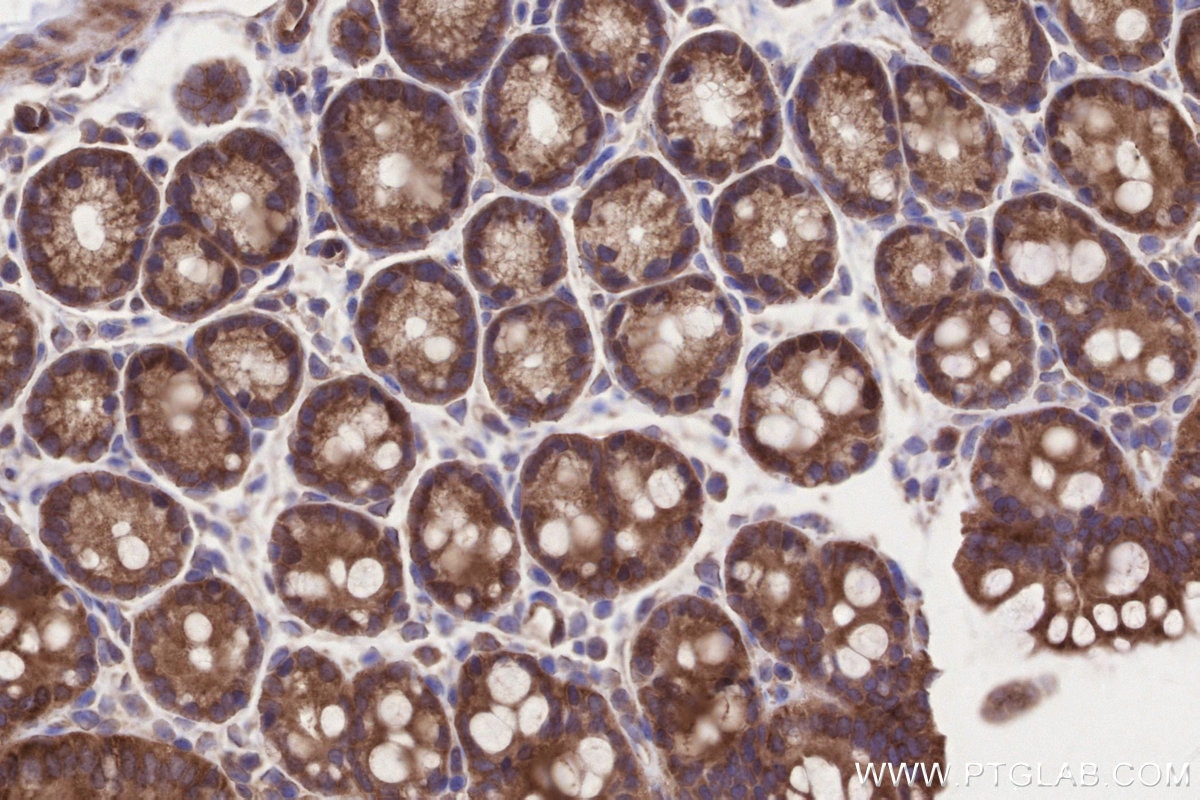 Immunohistochemistry (IHC) staining of mouse colon tissue using MRPL53 Polyclonal antibody (16142-1-AP)