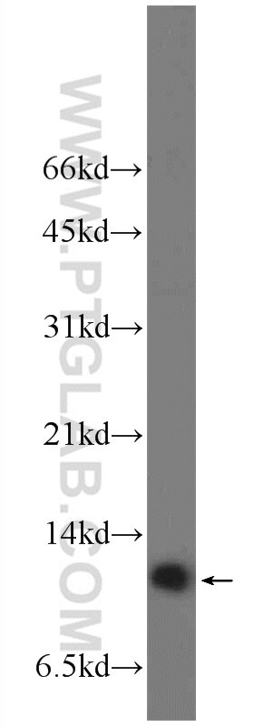 WB analysis of A549 using 16142-1-AP