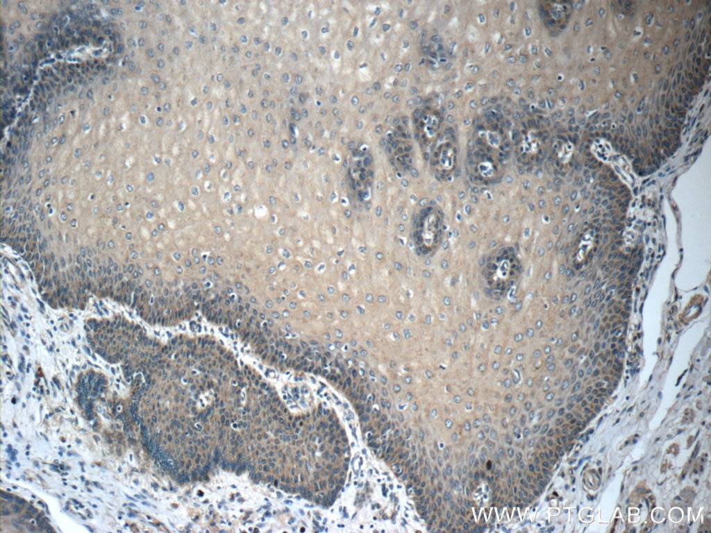 Immunohistochemistry (IHC) staining of human oesophagus tissue using MRPL54 Polyclonal antibody (17683-1-AP)