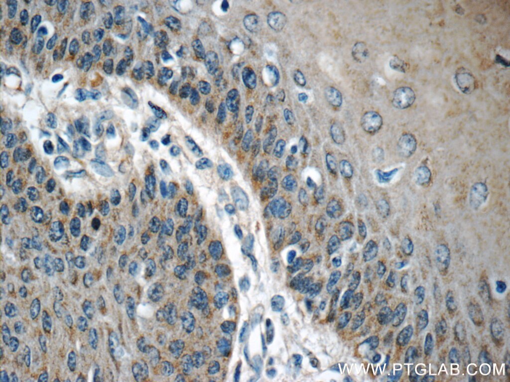 Immunohistochemistry (IHC) staining of human oesophagus tissue using MRPL54 Polyclonal antibody (17683-1-AP)