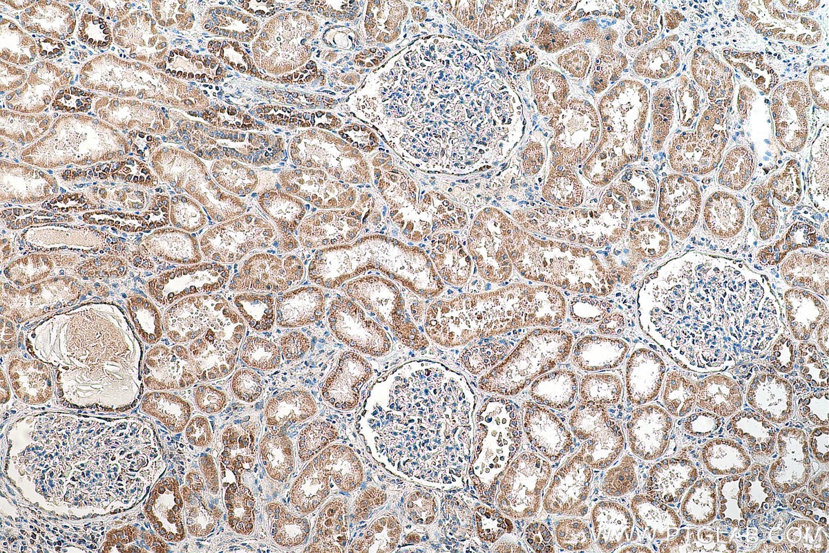 Immunohistochemistry (IHC) staining of human kidney tissue using MRPL55 Polyclonal antibody (17679-1-AP)