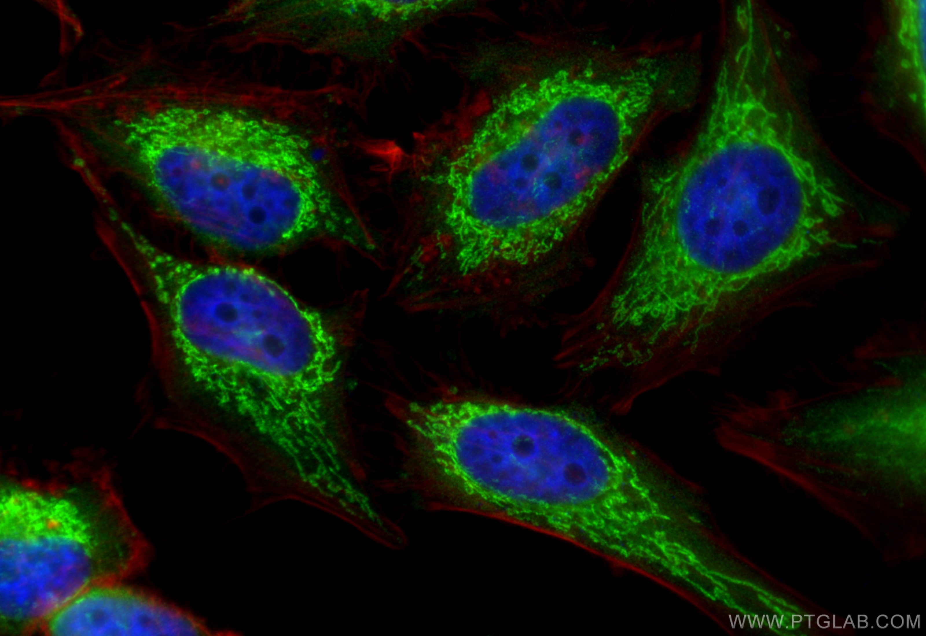 Immunofluorescence (IF) / fluorescent staining of HeLa cells using MRPL9 Polyclonal antibody (15342-1-AP)
