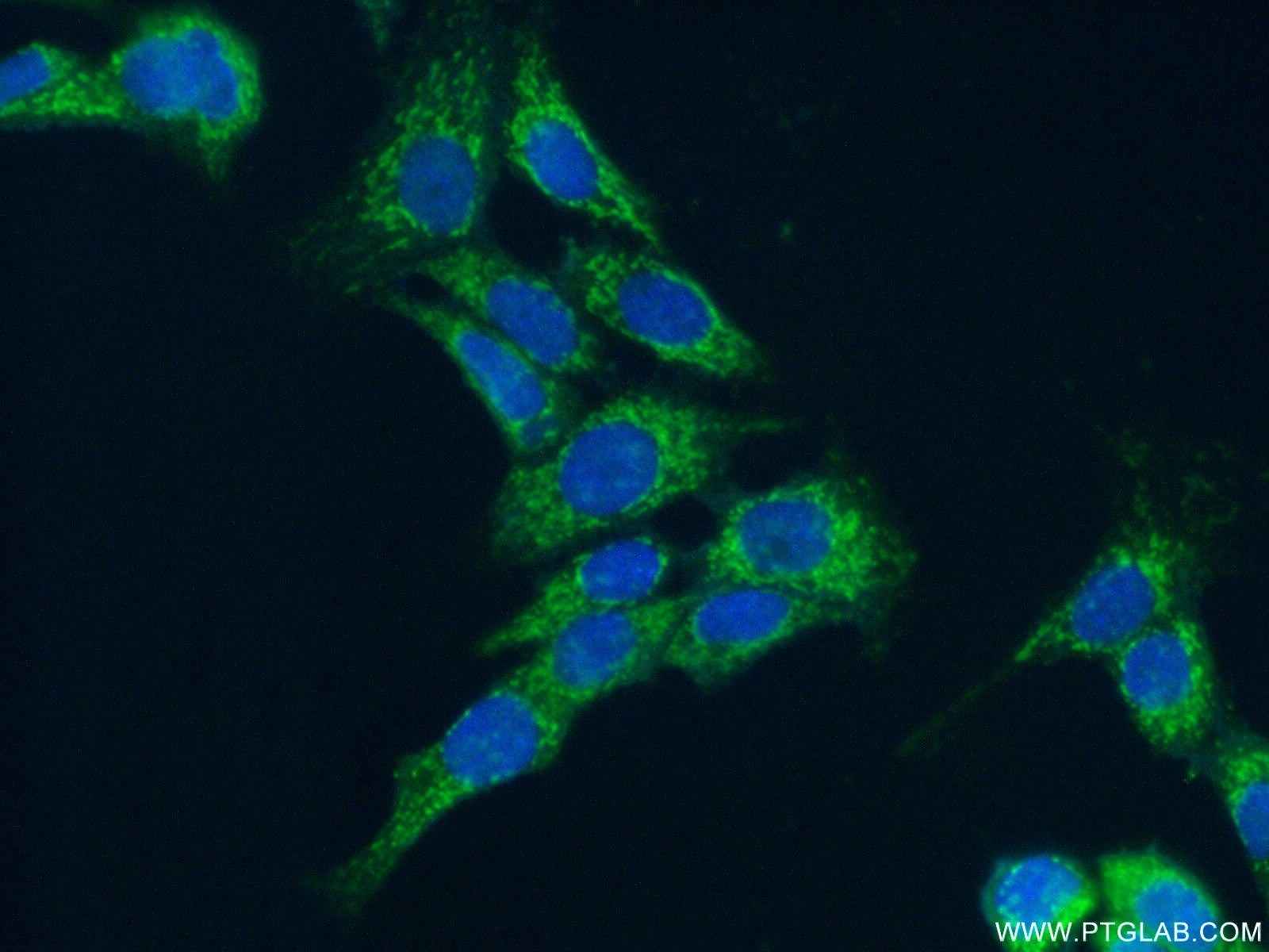 Immunofluorescence (IF) / fluorescent staining of MCF-7 cells using MRPL9 Polyclonal antibody (15342-1-AP)