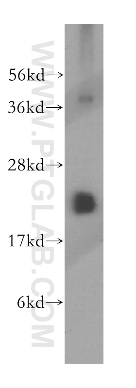 Western Blot (WB) analysis of HeLa cells using MRPS10 Polyclonal antibody (16030-1-AP)