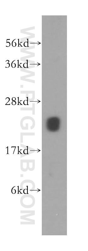 MRPS10 Polyclonal antibody