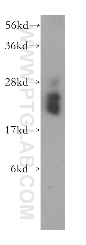 Western Blot (WB) analysis of human liver tissue using MRPS10 Polyclonal antibody (16030-1-AP)