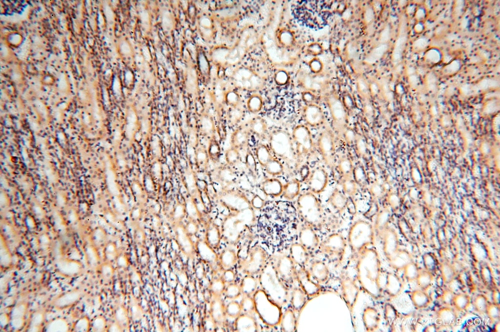 Immunohistochemistry (IHC) staining of human kidney tissue using MRPS11 Polyclonal antibody (17041-1-AP)