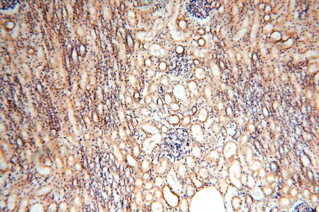 IHC staining of human kidney using 17041-1-AP