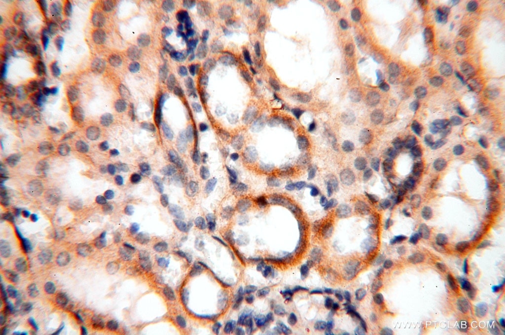 Immunohistochemistry (IHC) staining of human kidney tissue using MRPS11 Polyclonal antibody (17041-1-AP)