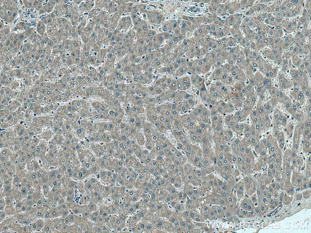 Immunohistochemistry (IHC) staining of human liver tissue using MRPS12 Polyclonal antibody (15225-1-AP)