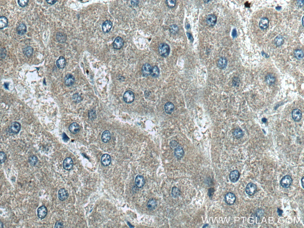 Immunohistochemistry (IHC) staining of human liver tissue using MRPS12 Polyclonal antibody (15225-1-AP)