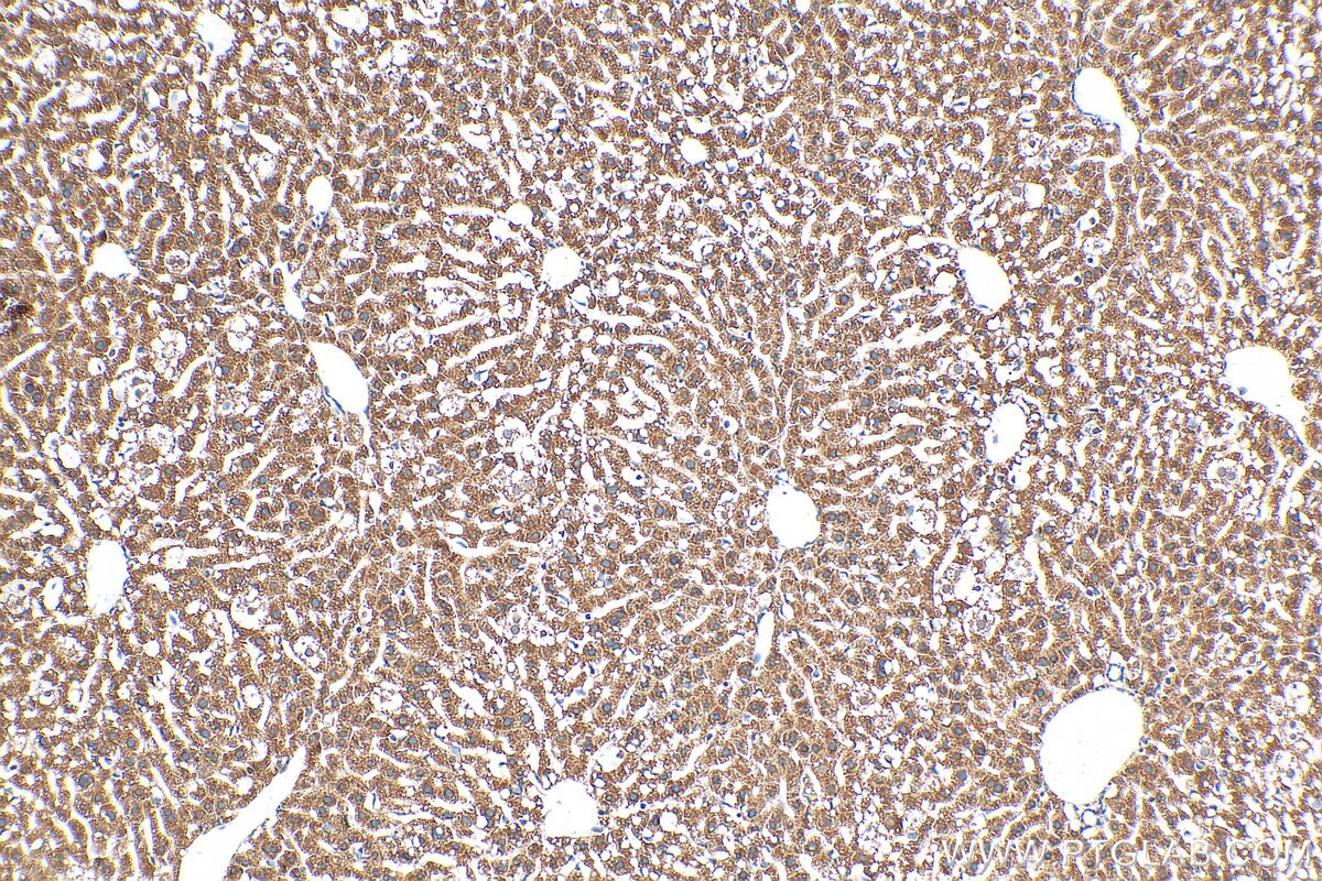 Immunohistochemistry (IHC) staining of mouse liver tissue using MRPS14 Polyclonal antibody (16301-1-AP)