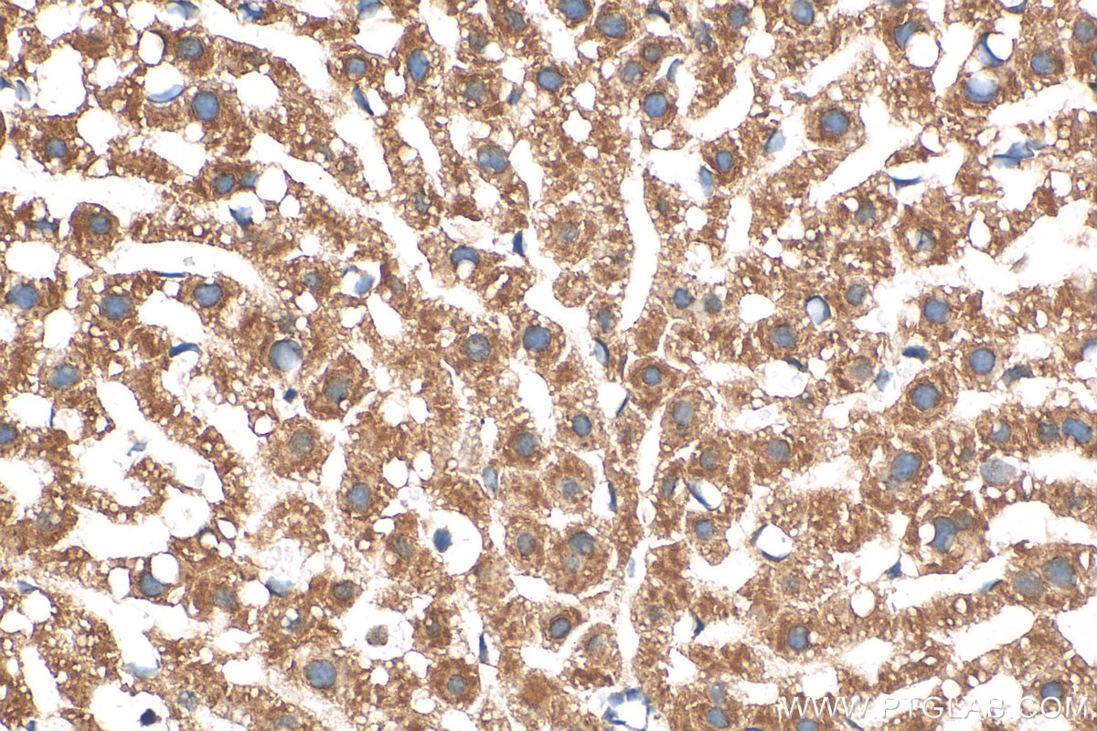 Immunohistochemistry (IHC) staining of mouse liver tissue using MRPS14 Polyclonal antibody (16301-1-AP)