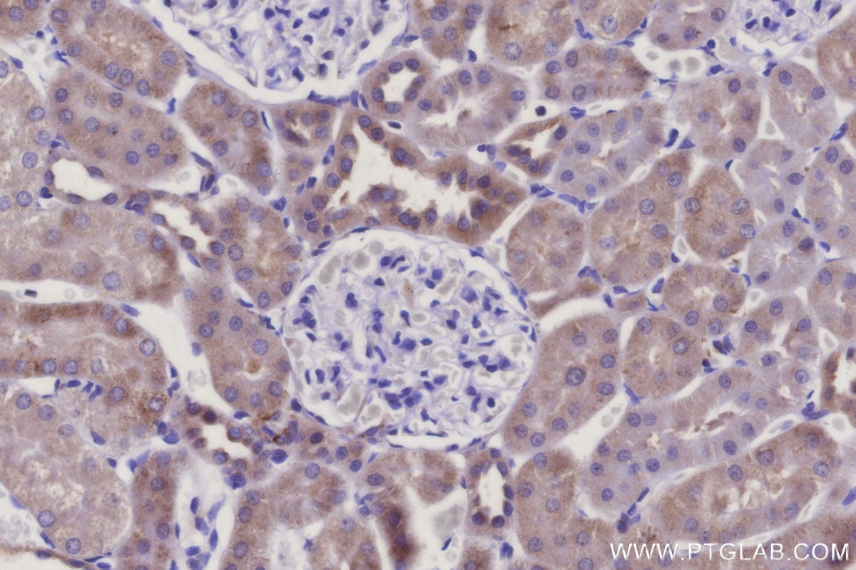 IHC staining of rat kidney using 16301-1-AP Immunohistochemistry (IHC) staining of rat kidney tissue using MRPS14 Polyclonal antibody (16301-1-AP)