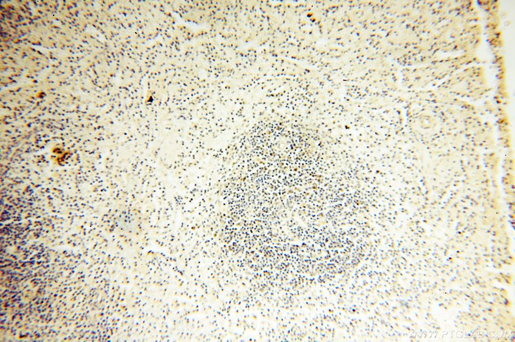 Immunohistochemistry (IHC) staining of human spleen tissue using MRPS15 Polyclonal antibody (17006-1-AP)