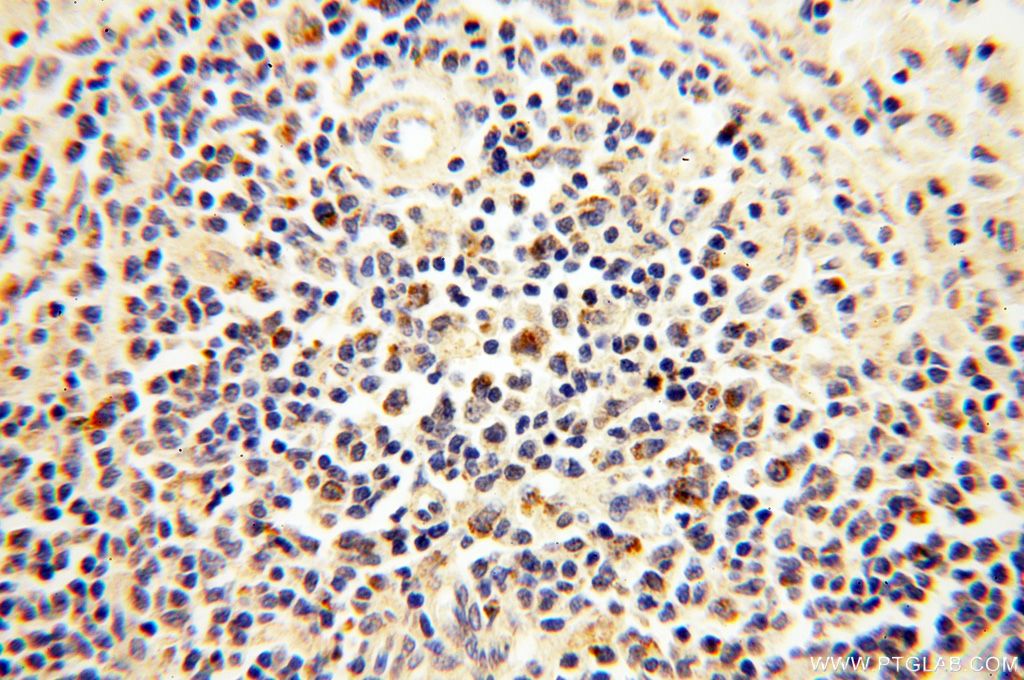 Immunohistochemistry (IHC) staining of human spleen tissue using MRPS15 Polyclonal antibody (17006-1-AP)