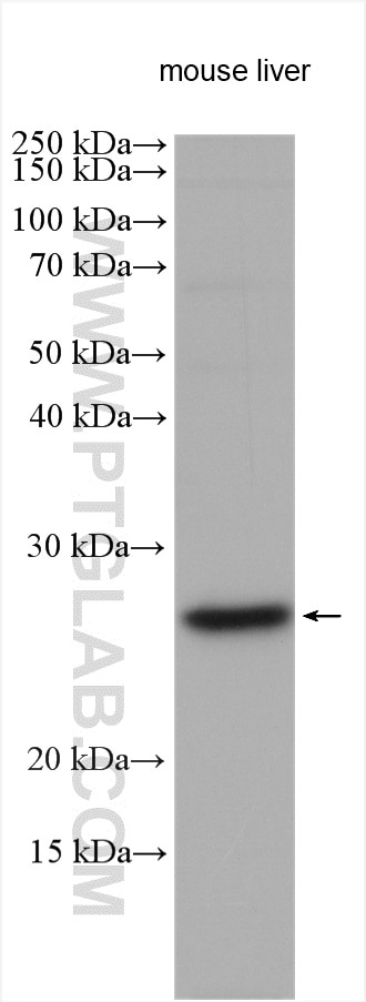 Western Blot (WB) analysis of various lysates using MRPS15 Polyclonal antibody (17006-1-AP)
