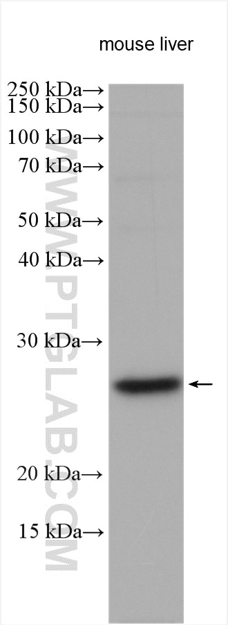 Western Blot (WB) analysis of various lysates using MRPS15 Polyclonal antibody (17006-1-AP)