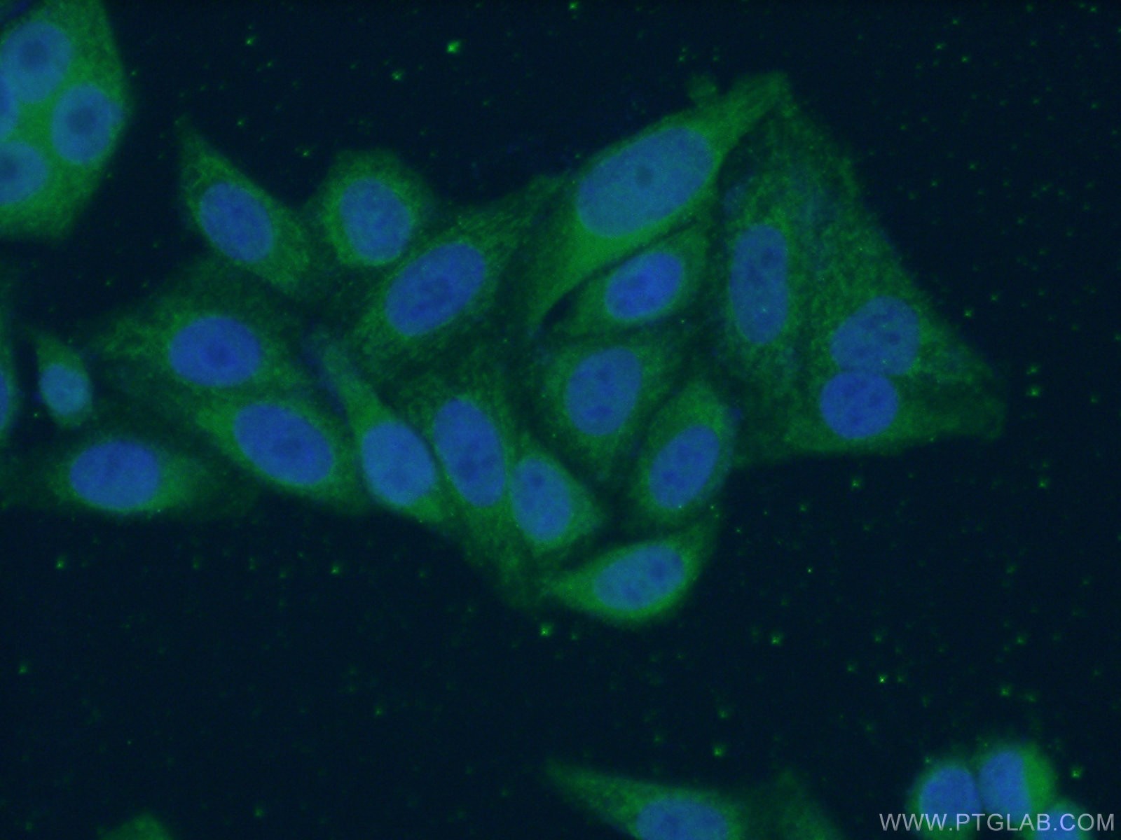 Immunofluorescence (IF) / fluorescent staining of HepG2 cells using MRPS16 Polyclonal antibody (16735-1-AP)