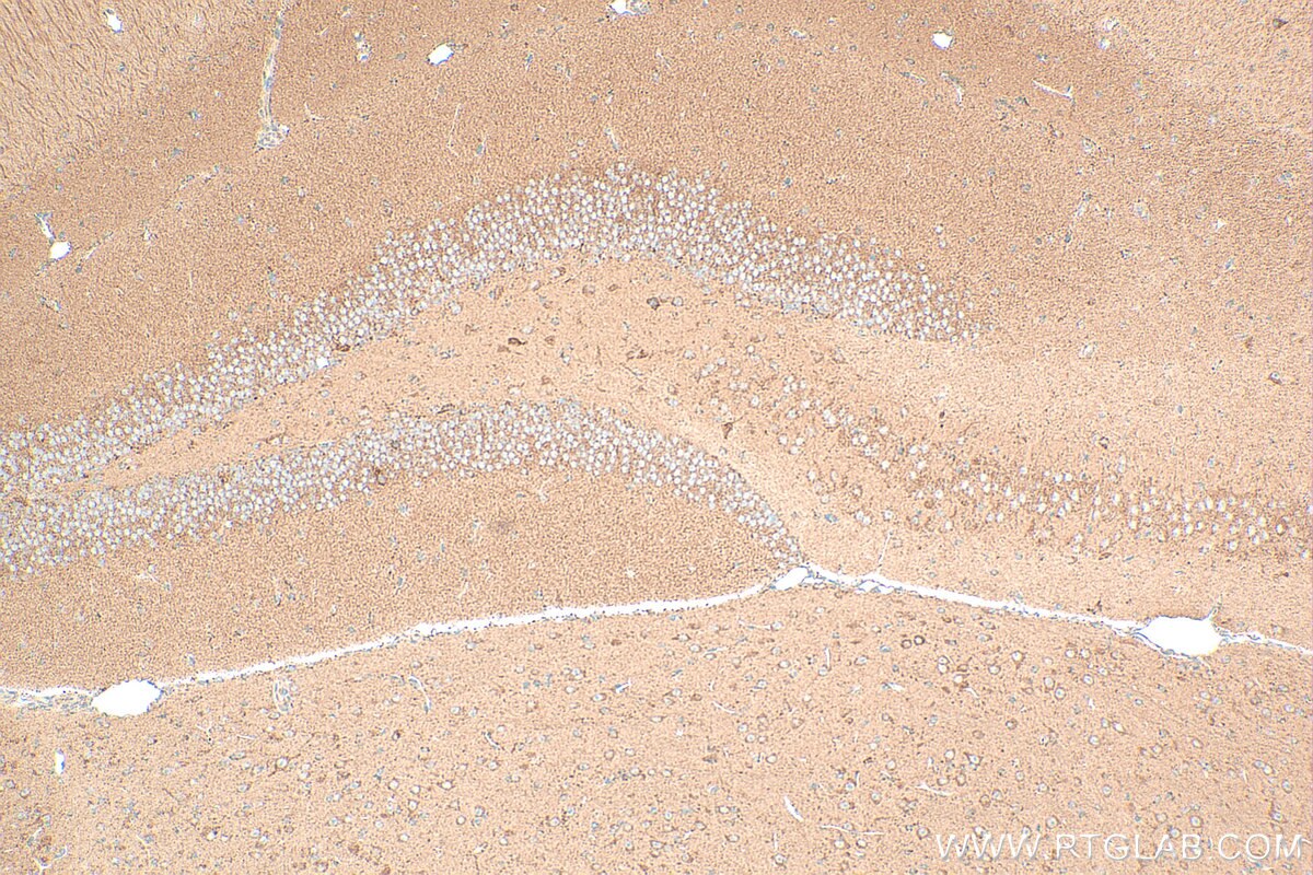 Immunohistochemistry (IHC) staining of mouse brain tissue using MRPS16 Polyclonal antibody (16735-1-AP)