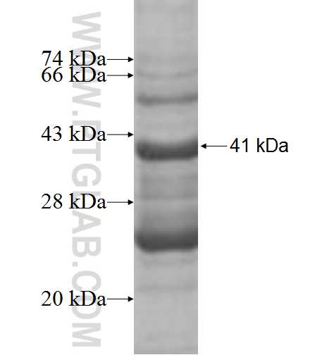 MRPS16 fusion protein Ag9749 SDS-PAGE
