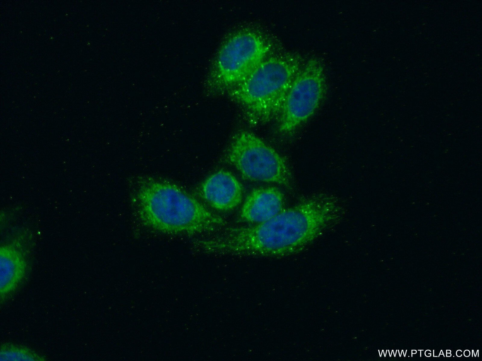 IF Staining of HepG2 using 18881-1-AP