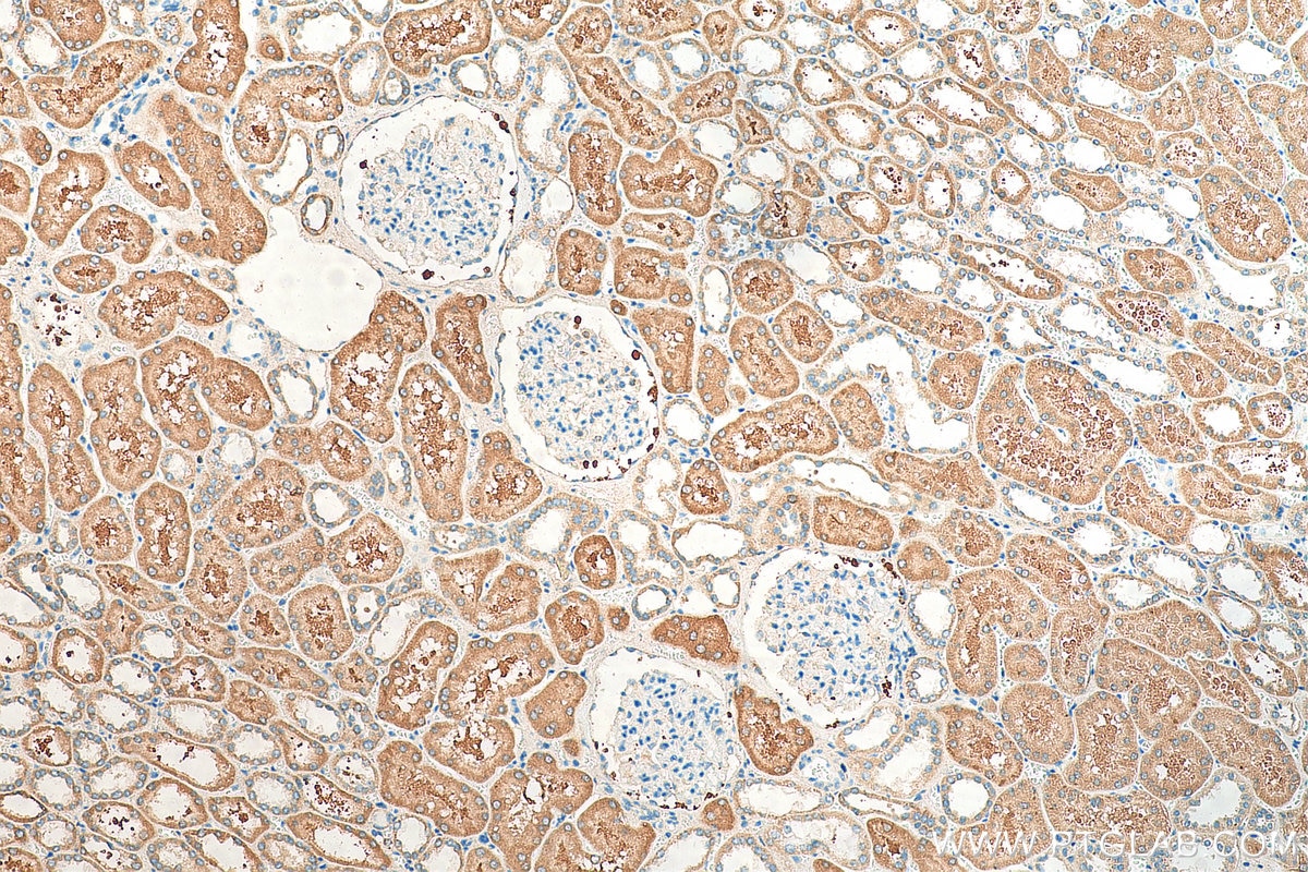 Immunohistochemistry (IHC) staining of human kidney tissue using MRPS17 Polyclonal antibody (18881-1-AP)
