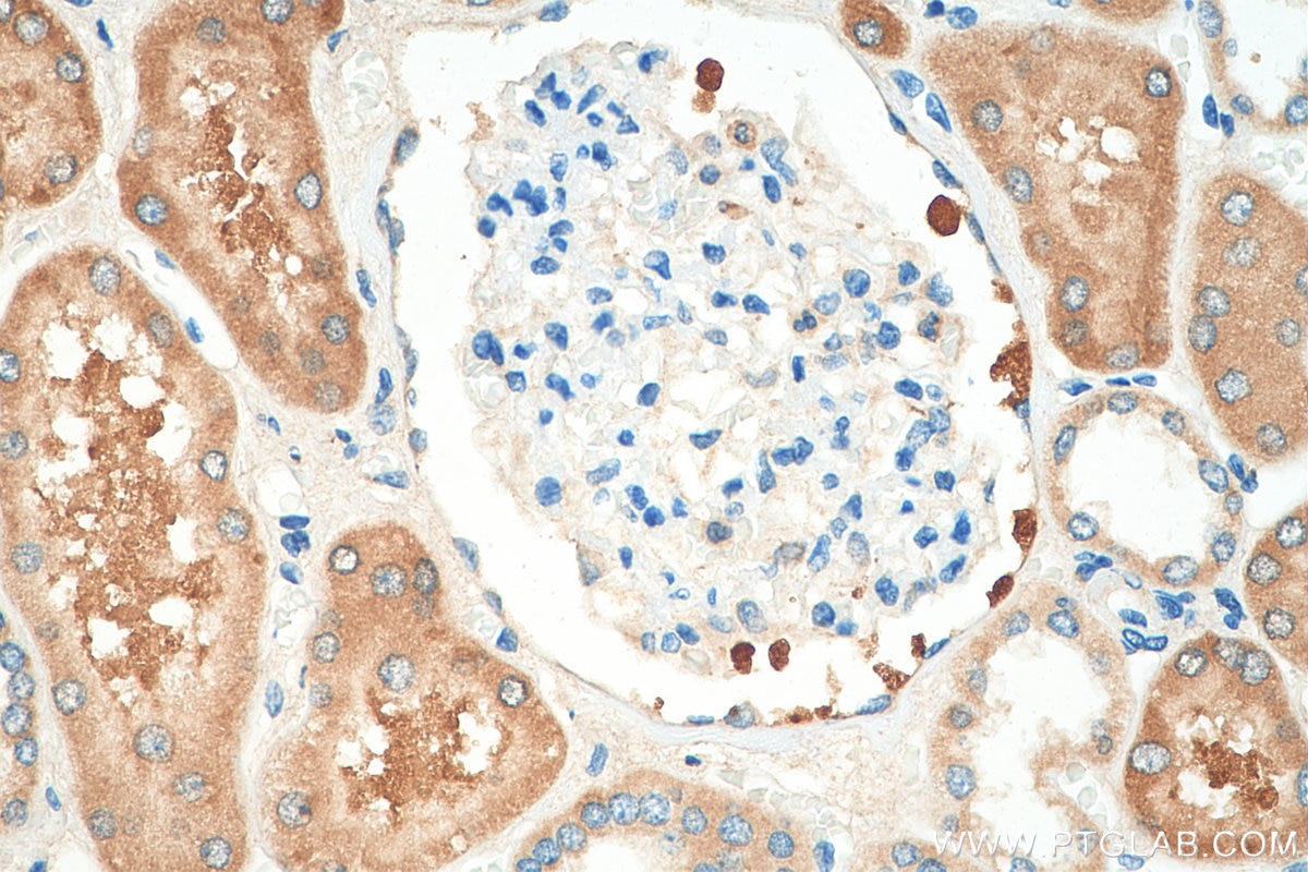 Immunohistochemistry (IHC) staining of human kidney tissue using MRPS17 Polyclonal antibody (18881-1-AP)