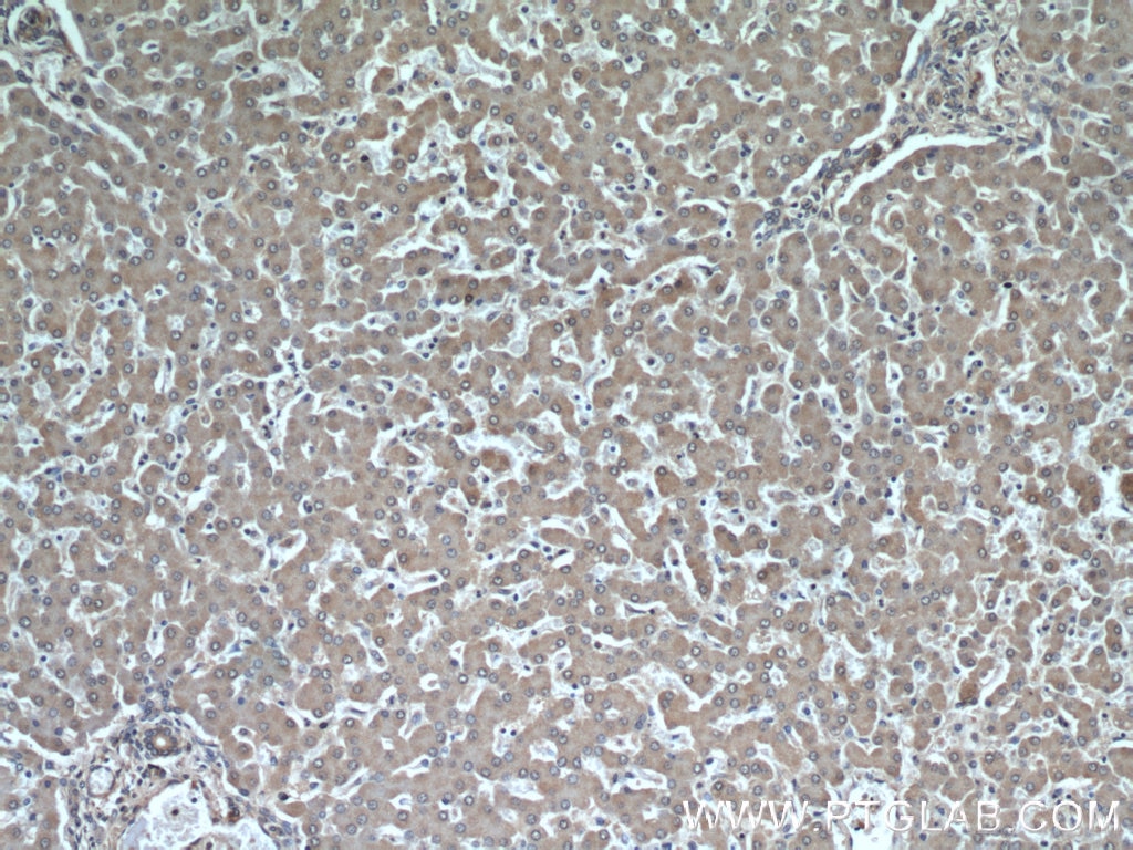 Immunohistochemistry (IHC) staining of human liver tissue using MRPS18B Polyclonal antibody (16139-1-AP)