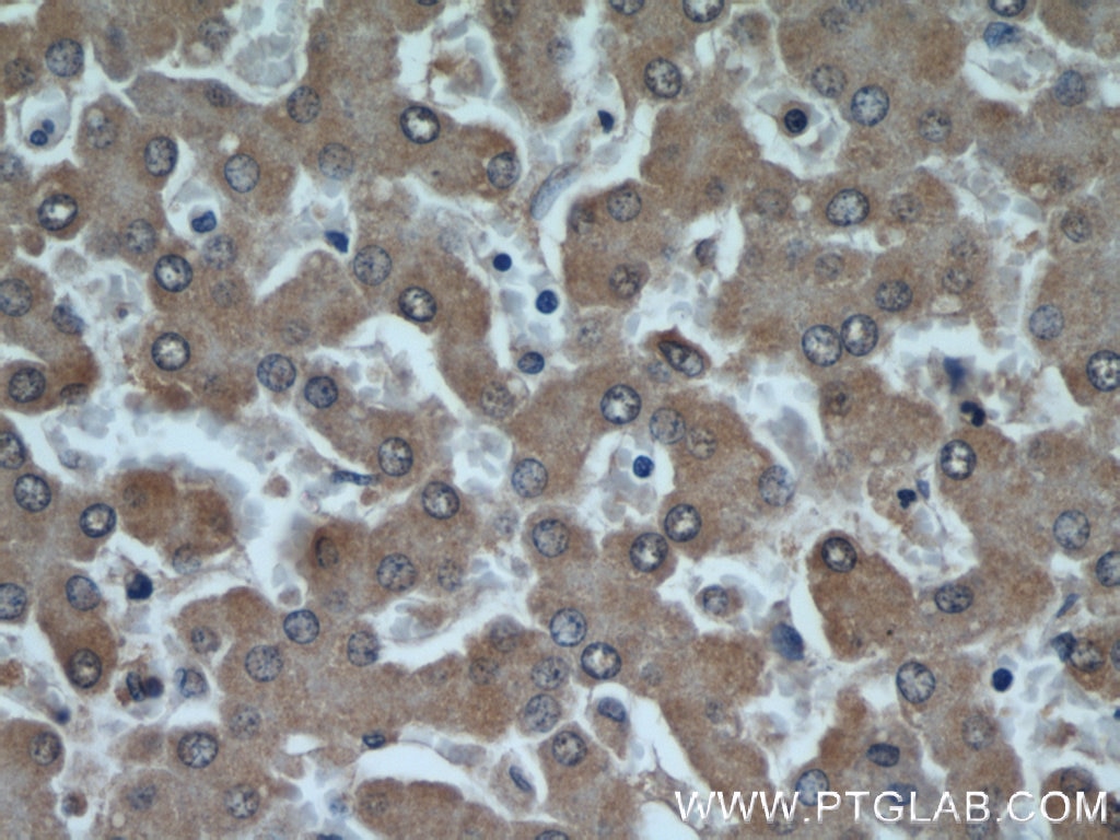 Immunohistochemistry (IHC) staining of human liver tissue using MRPS18B Polyclonal antibody (16139-1-AP)