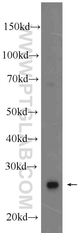 Western Blot (WB) analysis of rat heart tissue using MRPS18B Polyclonal antibody (16139-1-AP)