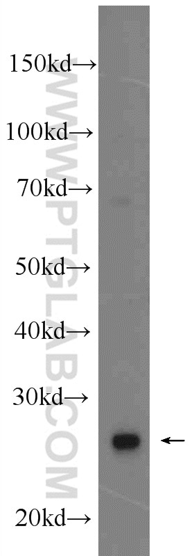 WB analysis of rat heart using 16139-1-AP