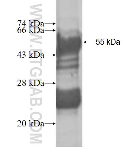 MRPS18B fusion protein Ag9198 SDS-PAGE