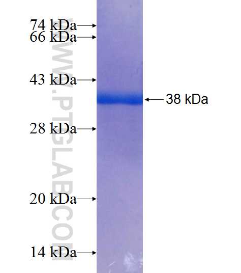 MRPS18B fusion protein Ag9308 SDS-PAGE