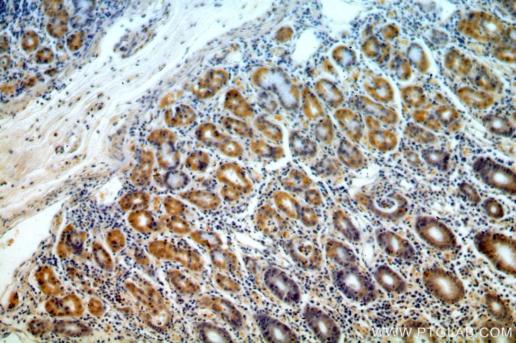 Immunohistochemistry (IHC) staining of human stomach tissue using MRPS2 Polyclonal antibody (15907-1-AP)