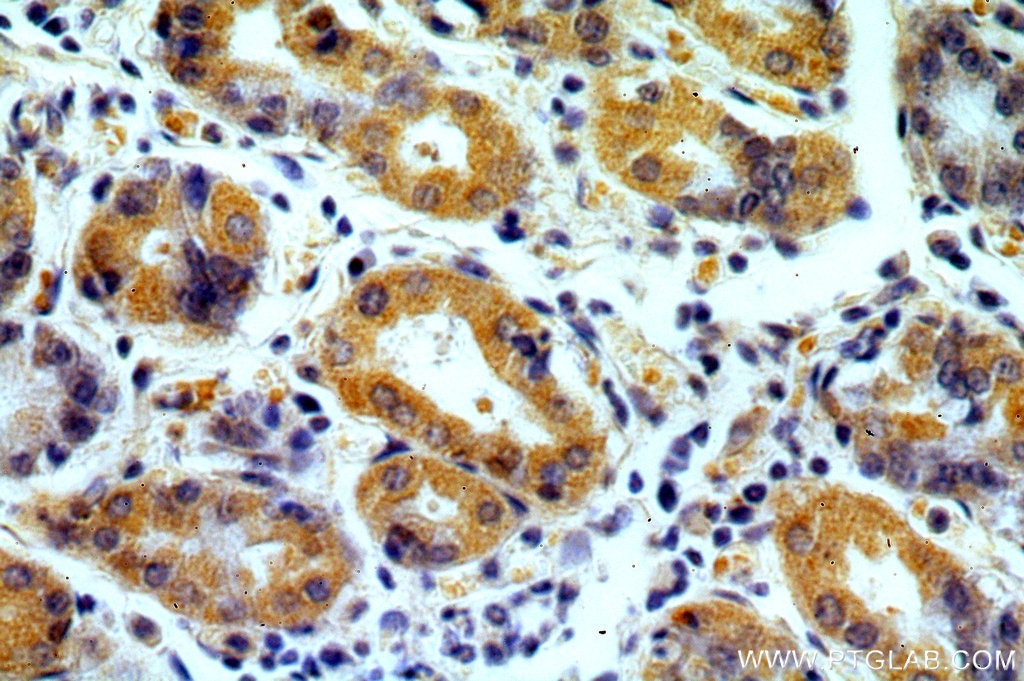 Immunohistochemistry (IHC) staining of human stomach tissue using MRPS2 Polyclonal antibody (15907-1-AP)