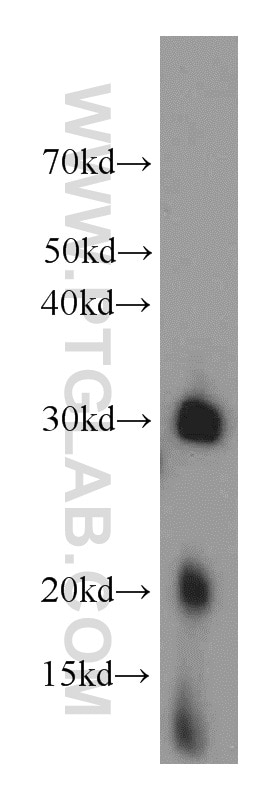 Western Blot (WB) analysis of mouse brain tissue using MRPS2 Polyclonal antibody (15907-1-AP)