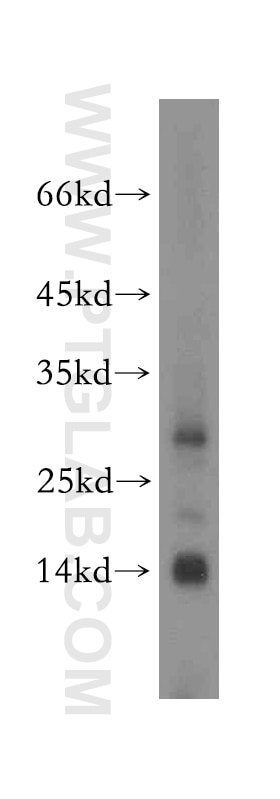 Western Blot (WB) analysis of mouse brain tissue using MRPS2 Polyclonal antibody (15907-1-AP)