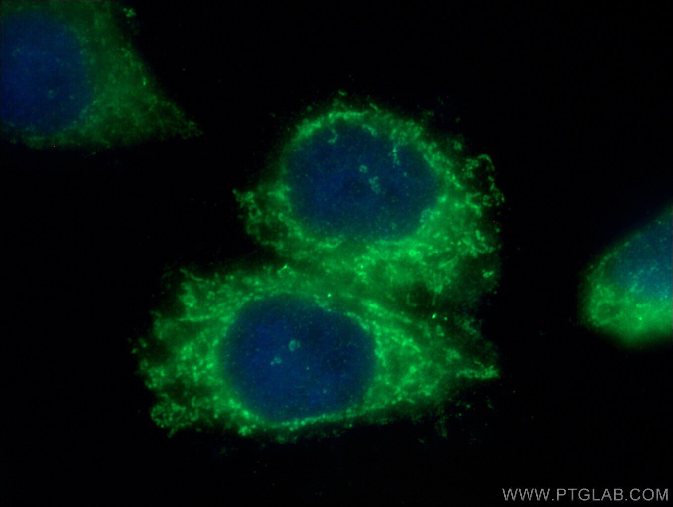 IF Staining of HepG2 using 16359-1-AP