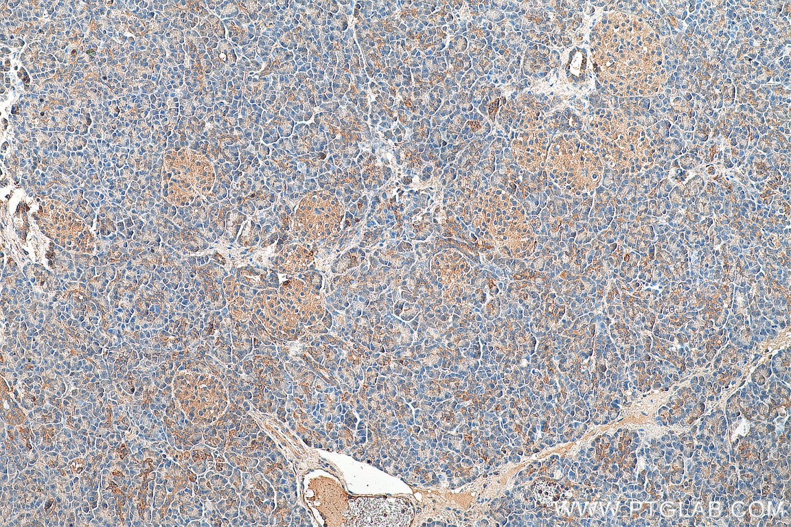 Immunohistochemistry (IHC) staining of human pancreas tissue using MRPS21 Polyclonal antibody (16359-1-AP)
