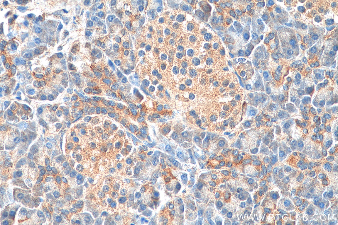 Immunohistochemistry (IHC) staining of human pancreas tissue using MRPS21 Polyclonal antibody (16359-1-AP)