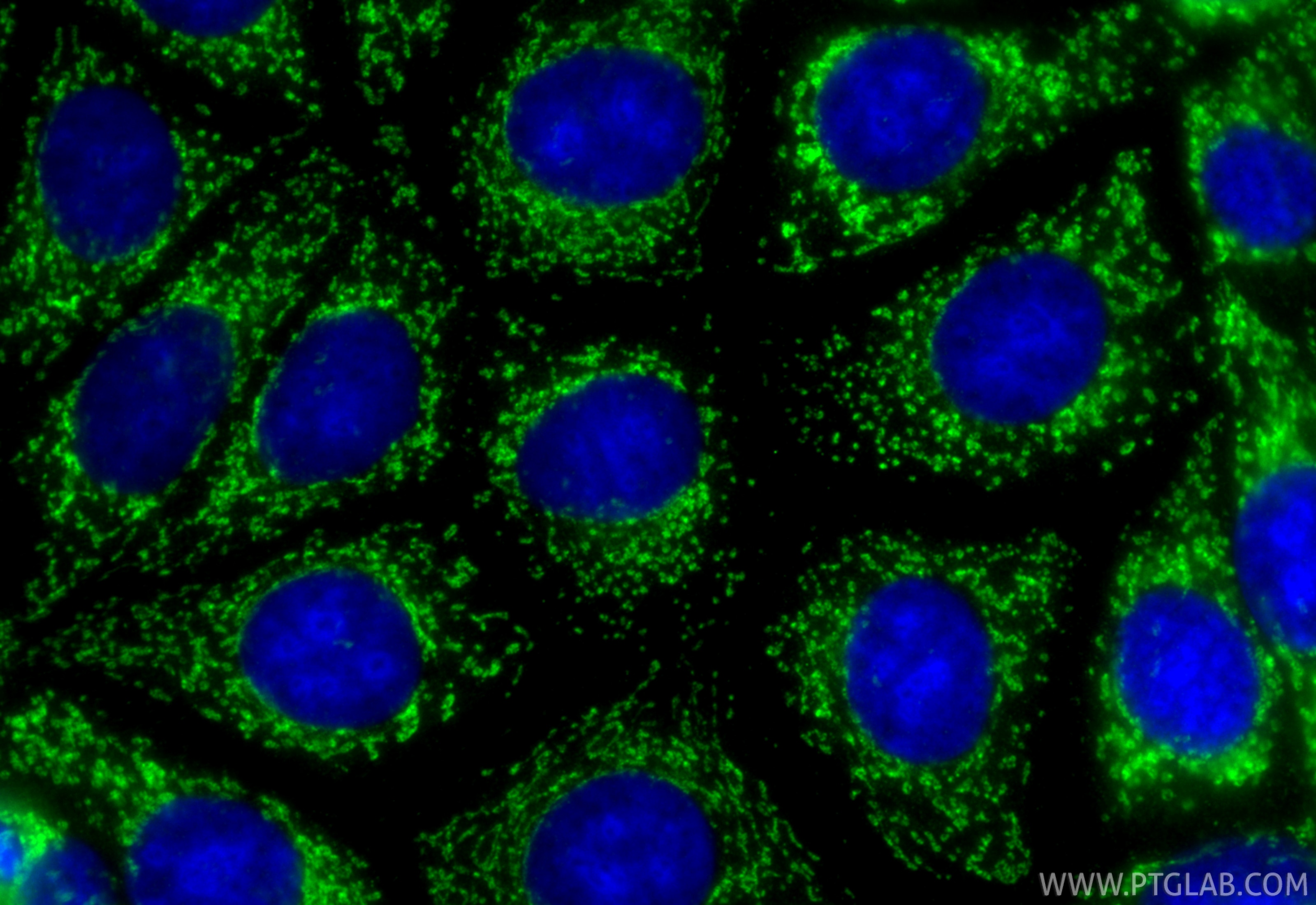 IF Staining of MCF-7 using 10984-1-AP Immunofluorescence (IF) / fluorescent staining of MCF-7 cells using MRPS22 Polyclonal antibody (10984-1-AP)