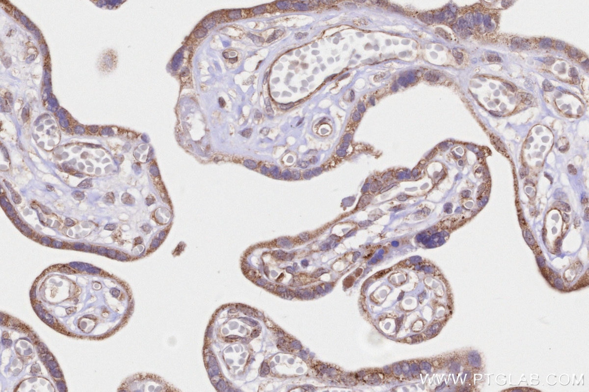 Immunohistochemistry (IHC) staining of human placenta tissue using MRPS22 Polyclonal antibody (10984-1-AP)